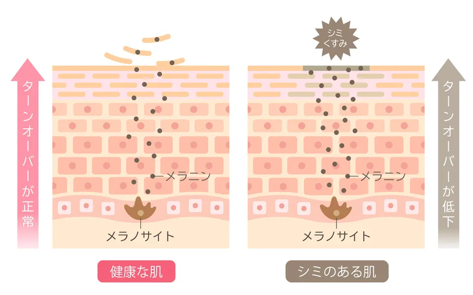 シミができる仕組み