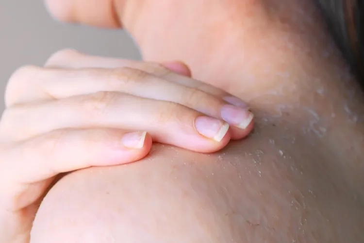 乾燥肌対策｜原因から改善法まで徹底解説！