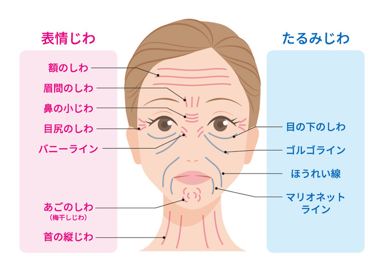 顔のシワ