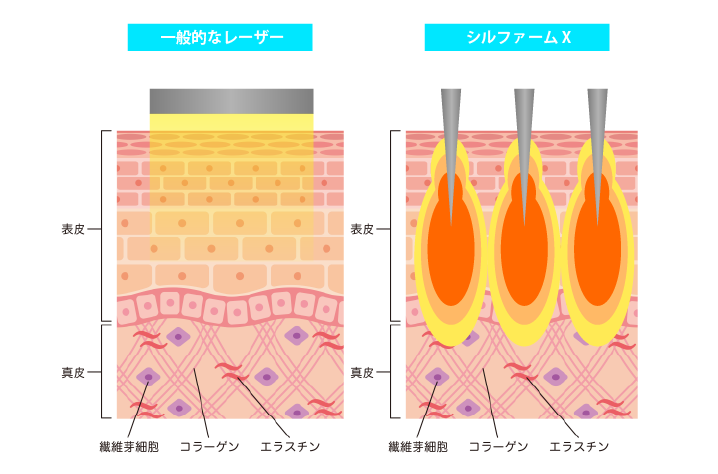 シルファーム比較