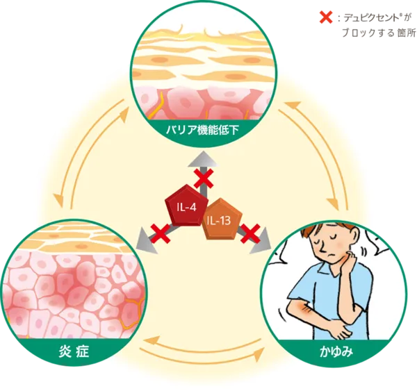 デュピクセントの作用